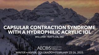 Capsular Contraction Syndrome with a Hydrophilic Acrylic IOL